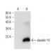 western blotting image from recommended claudin-10 (H-10) monoclonal antibody replacement. Image 146411