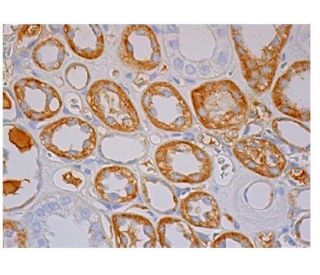 claudin-19 Antibody (D-9) - Immunohistochemistry - Image 350178 