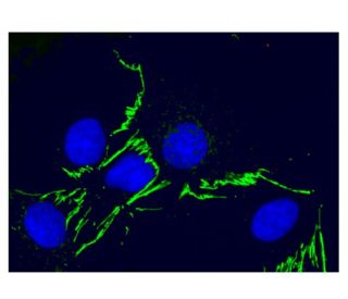 immunofluorescence image from recommended claudin-6 (A-4) monoclonal antibody replacement. Image 302181