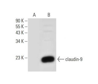 claudin-9 Antibody (E-7) - Western Blotting - Image 309580SAM Transcription Activation: SAM system utilizing dCas9-VP64, MS2-P65-HSF1, and sgRNA for precise gene transcription activation. 