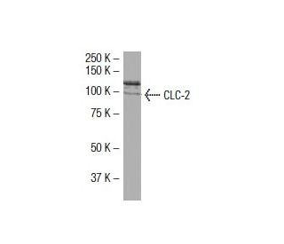 FAM200A Antibody (Z-9) - Western Blotting - Image 33519