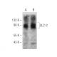 western blotting image from recommended CLC-3 (H-4) monoclonal antibody replacement. Image 285157