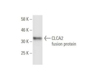 CLCA2 Antibody (1D5) - Western Blotting - Image 349006
