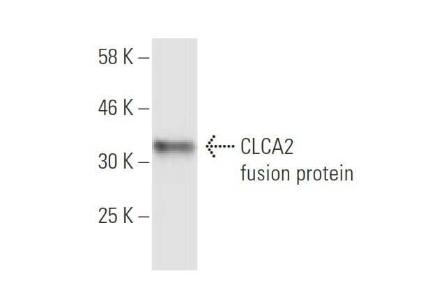 Anti-CLCA2 Antibody (1D5) | SCBT - Santa Cruz Biotechnology