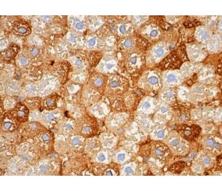 cleaved Thrombin APII Antibody (G-1) - Immunohistochemistry - Image 383503 