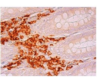 CLEC-4E Antibody (E-5) - Immunohistochemistry - Image 304575 