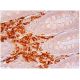 CLEC-4E Antibody (E-5) - Immunohistochemistry - Image 304575 