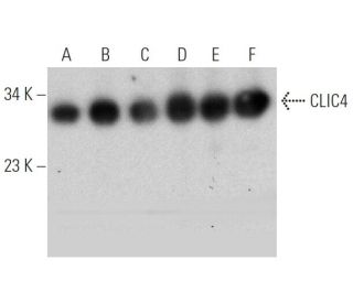 CLIC4 Antibody (45.42) - Western Blotting - Image 360078 