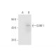 CLIM-1 Antibody (Q7) - Western Blotting - Image 66262