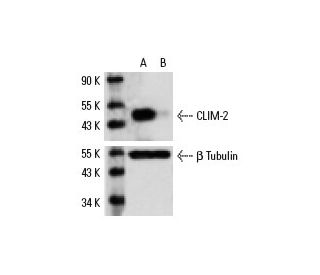 CLIM-2 siRNA (h): sc-35072. Western blot analysis of CLIM-2 expression in non-transfected control (A) and CLIM-2 transfect 