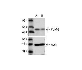 CLIM-2 siRNA (m): sc-35073. Western blot analysis of CLIM-2 expression in non-transfected control (A) and CLIM-2 transfect 
