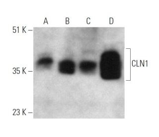 CLN1 Antibody (1117CT11.2.1.4) - Western Blotting - Image 374598SAM Transcription Activation: SAM system utilizing dCas9-VP64, MS2-P65-HSF1, and sgRNA for precise gene transcription activation. 