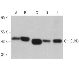 CLN3 Antibody (C-1) - Western Blotting - Image 359227 