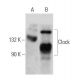 Questo anticorpo policlonale è stato sospeso. Consulta il nostro anticorpo monoclonale <a href="clock-antibody-c-8">Clock (C-8)</a> raccomandato (sono riportati i dati del campione). western blotting image from recommended Clock (C-8) monoclonal antibody replacement. Image 358551