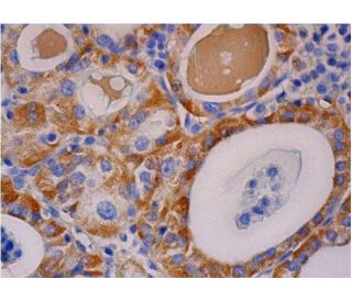 CLPTM1 Antibody (G-7) - Immunohistochemistry - Image 286261 