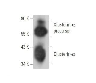 Clusterin-α Antibody (B-5) | SCBT - Santa Cruz Biotechnology