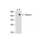 Clusterin Antibody (CLI-9) - Western Blotting - Image 20424 