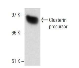 Clusterin Antibody (Hs-3) - Western Blotting - Image 17748