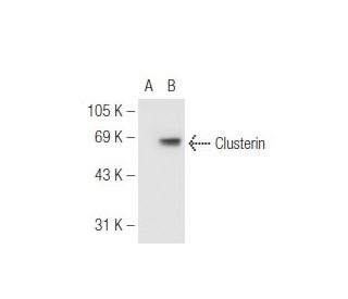 Clusterin Antibody (CLI-9) - Western Blotting - Image 65417