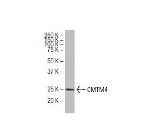 CMTM4 Antibody (1E8) - Western Blotting - Image 33593SAM Transcription Activation: SAM system utilizing dCas9-VP64, MS2-P65-HSF1, and sgRNA for precise gene transcription activation.