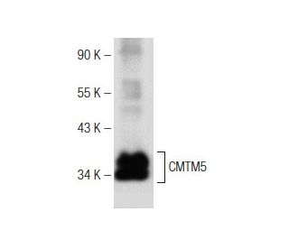 CMTM5 Antibody (A-11) - Western Blotting - Image 149226 