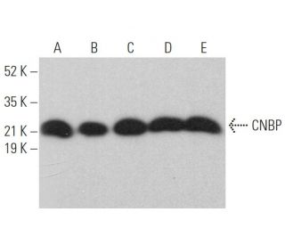 CNBP Antibody (H-7) - Western Blotting - Image 374400 