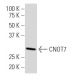 CNOT7 Antibody (18W) - Western Blotting - Image 34373 