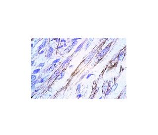 CNTFRÎ+/- Antibody (R-20): sc-1914