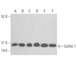 Cofilin 1 Antibody (5) - Western Blotting - Image 353963Each CRISPR/Cas9 Knockout (KO) Plasmid product consists of a pool of 3 plasmids designed to ensure identification and cleavage of a specific gene for maximum knockout efficiency. Each plasmid encodes a unique 20 nt sequence derived from the GeCKO (v2) library. 