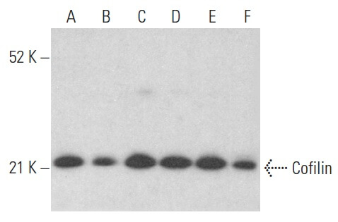 Cofilin Antibody E 8 SCBT Santa Cruz Biotechnology