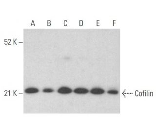 western blotting image from recommended Cofilin (E-8) monoclonal antibody replacement. Image 353996