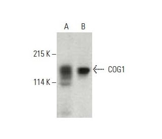 COG1 Antibody (44) - Western Blotting - Image 396647