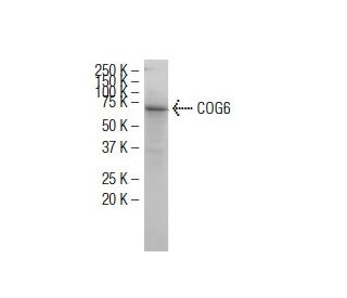 COG6 Antibody (RR2) - Western Blotting - Image 34634Each CRISPR/Cas9 Knockout (KO) Plasmid product consists of a pool of 3 plasmids designed to ensure identification and cleavage of a specific gene for maximum knockout efficiency. Each plasmid encodes a unique 20 nt sequence derived from the GeCKO (v2) library.