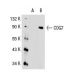COG7 Antibody (L-06) - Western Blotting - Image 31216