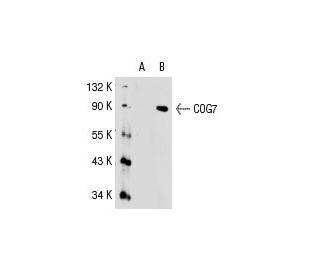 COG7 Antibody (L-06) - Western Blotting - Image 31216