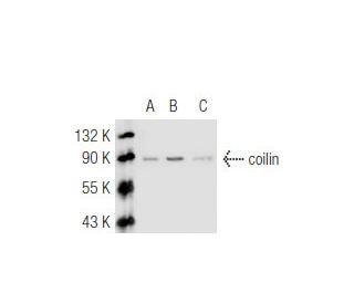 western blotting image from recommended coilin (F-7) monoclonal antibody replacement. Image 46141