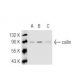 This polyclonal antibody has been discontinued. See our recommended <a href="coilin-antibody-f-7">coilin (F-7)</a> monoclonal antibody (sample data shown). western blotting image from recommended coilin (F-7) monoclonal antibody replacement. Image 46141