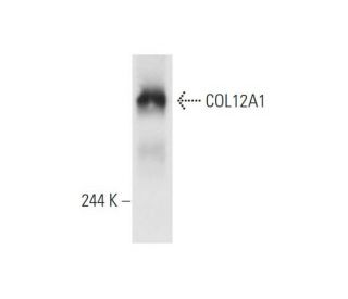 COL12A1 Antibody (A-11) - Western Blotting - Image 63006The Double Nickase Plasmid features a U6 promoter for sgRNA expression, a 20 nt targeting sequence, and a gRNA scaffold to guide Cas9n. It includes a CBh promoter for Cas9n (D10A) and puromycin resistance, GFP for transfection verification, and nuclear localization signals (NLS). The 2A peptide allows co-expression of Cas9n and Puro from a single promoter, enabling precise genome editing with reduced off-target effects. 