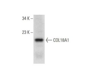 COL18A1 Antibody (F-6) - Western Blotting - Image 318548