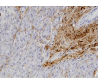 immunohistochemistry image from recommended COL1A1 (3G3) monoclonal antibody replacement. Image 346114