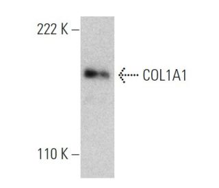 COL1A1 Antibody (3G3) - Western Blotting - Image 366610