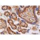 immunohistochemistry image from recommended COL1A2 (E-6) monoclonal antibody replacement. Image 361446