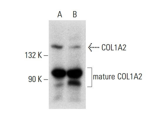 COL1A2 Antibody (E-6) | SCBT - Santa Cruz Biotechnology