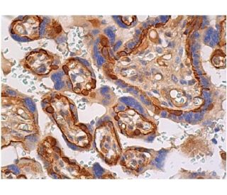 immunohistochemistry image from recommended COL1A2 (E-6) monoclonal antibody replacement. Image 361446