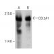 Este anticuerpo policlonal ha dejado de fabricarse. Consulta nuestro anticuerpo monoclonal recomendado <a href="col2a1-antibody-b-1">COL2A1 (B-1)</a> (se muestran datos de muestra). western blotting image from recommended COL2A1 (B-1) monoclonal antibody replacement. Image 387365