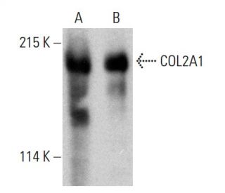 western blotting image from recommended COL2A1 (B-1) monoclonal antibody replacement. Image 387365