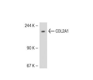 COL2A1 Antibody (M2139) - Western Blotting - Image 51726