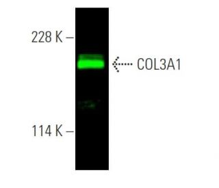 COL3A1 Antibody (B-10) - Western Blotting - Image 375700 