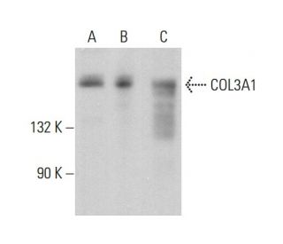 OURNALSTANDARDrelume オールインワン COL3A1 Antibody (B-10) | SCBT - Santa Cruz Biotechnology