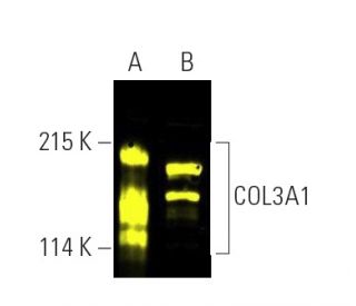 COL3A1 Antibody (B-10) | SCBT - Santa Cruz Biotechnology
